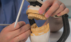 Προσθετική