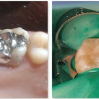 amagalma-resin-1 squared